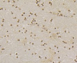 Invitrogen RAD21 Polyclonal Antibody 100 μL; Unconjugated:Antibodies,