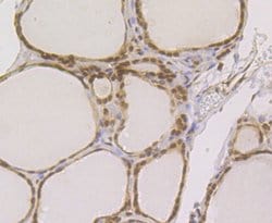 Invitrogen RAD21 Polyclonal Antibody 100 μL; Unconjugated:Antibodies,