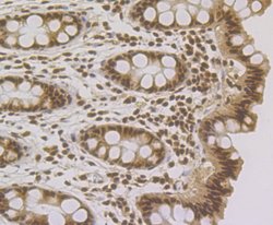 Invitrogen RAD21 Polyclonal Antibody 100 μL; Unconjugated:Antibodies,