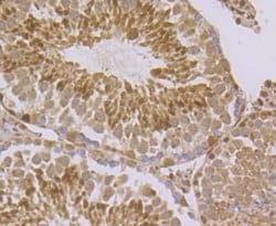Invitrogen RAD21 Polyclonal Antibody 100 μL; Unconjugated:Antibodies,