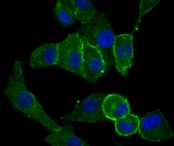 Invitrogen CD13 Polyclonal Antibody 100 &mu;L; Unconjugated:Antibodies,