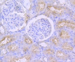 Invitrogen CD13 Polyclonal Antibody 100 &mu;L; Unconjugated:Antibodies,