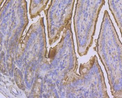Invitrogen CD13 Polyclonal Antibody 100 &mu;L; Unconjugated:Antibodies,