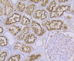 Invitrogen CD13 Polyclonal Antibody 100 &mu;L; Unconjugated:Antibodies,