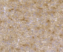Invitrogen CD13 Polyclonal Antibody 100 &mu;L; Unconjugated:Antibodies,