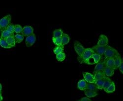 Invitrogen Perforin Polyclonal Antibody 100 &mu;L; Unconjugated:Antibodies,