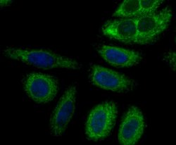 Invitrogen Perforin Polyclonal Antibody 100 &mu;L; Unconjugated:Antibodies,