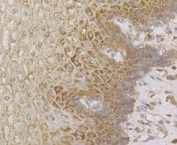 Invitrogen Perforin Polyclonal Antibody 100 &mu;L; Unconjugated:Antibodies,