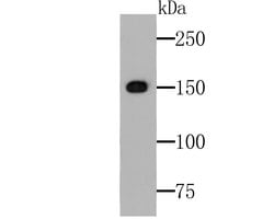 Invitrogen TRPA1 Polyclonal Antibody 100 μL; Unconjugated:Antibodies,
