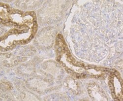 Invitrogen Connexin 45 Polyclonal Antibody 100 &mu;L; Unconjugated:Antibodies,