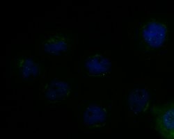 Invitrogen MICA/B Polyclonal Antibody 100 &mu;L; Unconjugated:Antibodies,