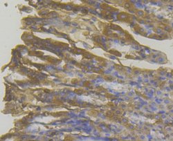 Invitrogen MICA/B Polyclonal Antibody 100 &mu;L; Unconjugated:Antibodies,