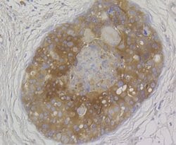 Invitrogen MICA/B Polyclonal Antibody 100 &mu;L; Unconjugated:Antibodies,