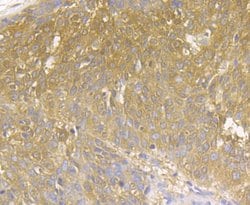 Invitrogen MICA/B Polyclonal Antibody 100 &mu;L; Unconjugated:Antibodies,