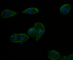 Invitrogen Kir6.2 (KCNJ11) Polyclonal Antibody 100 μL; Unconjugated:Antibodies,