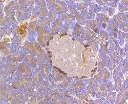 Invitrogen Kir6.2 (KCNJ11) Polyclonal Antibody 100 μL; Unconjugated:Antibodies,