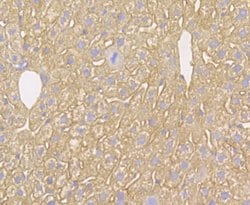 Invitrogen Kir6.2 (KCNJ11) Polyclonal Antibody 100 μL; Unconjugated:Antibodies,