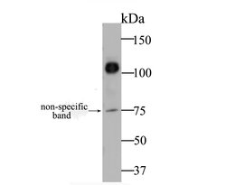 Invitrogen CDH17 Polyclonal Antibody 100 &mu;L; Unconjugated:Antibodies