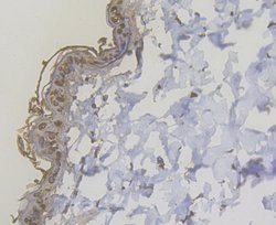 Invitrogen Cytokeratin 5 Polyclonal Antibody 100 &mu;L; Unconjugated:Antibodies,