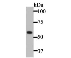 Invitrogen Cytokeratin 5 Polyclonal Antibody 100 &mu;L; Unconjugated:Antibodies,