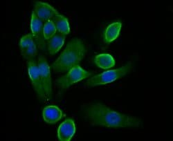 Thermo Scientific STIM2 Polyclonal Antibody:Antibodies, Polyclonal