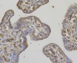 Thermo Scientific STIM2 Polyclonal Antibody:Antibodies, Polyclonal