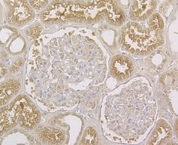 Thermo Scientific STIM2 Polyclonal Antibody:Antibodies, Polyclonal