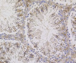 Thermo Scientific STIM2 Polyclonal Antibody:Antibodies, Polyclonal