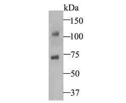 Thermo Scientific STIM2 Polyclonal Antibody:Antibodies, Polyclonal