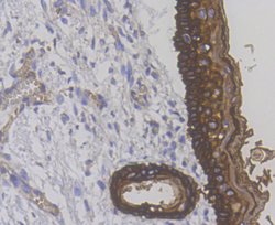 Invitrogen Cytokeratin 14 Polyclonal Antibody 100 μL; Unconjugated:Antibodies,