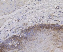 Invitrogen Cytokeratin 14 Polyclonal Antibody 100 μL; Unconjugated:Antibodies,