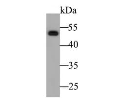 Invitrogen Cytokeratin 14 Polyclonal Antibody 100 μL; Unconjugated:Antibodies,
