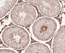 Invitrogen DFNA5 Polyclonal Antibody 100 &mu;L | Buy Online | Invitrogen&trade; | Fisher Scientific