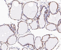 Invitrogen DFNA5 Polyclonal Antibody 100 &mu;L | Buy Online | Invitrogen&trade; | Fisher Scientific