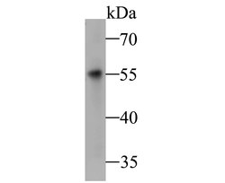 Invitrogen DFNA5 Polyclonal Antibody 100 &mu;L | Buy Online | Invitrogen&trade; | Fisher Scientific