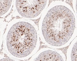 Invitrogen SSRP1 Polyclonal Antibody 100 μL; Unconjugated:Antibodies,