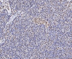 Thermo Scientific SSB Polyclonal Antibody:Antibodies, Polyclonal