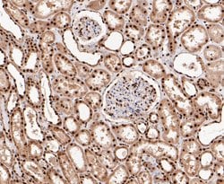 Thermo Scientific SSB Polyclonal Antibody:Antibodies, Polyclonal