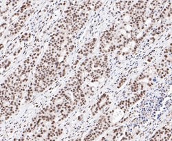 Thermo Scientific SSB Polyclonal Antibody:Antibodies, Polyclonal