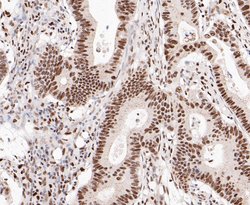 Thermo Scientific SSB Polyclonal Antibody:Antibodies, Polyclonal