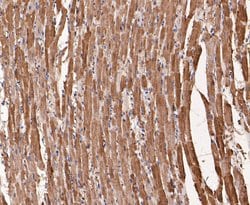 Invitrogen Myoglobin Polyclonal Antibody 100 μL; Unconjugated:Antibodies,