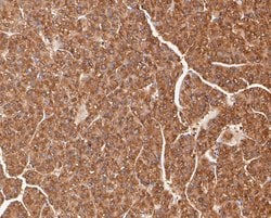 Invitrogen TRPML3 Polyclonal Antibody 100 &mu;L; Unconjugated:Antibodies,