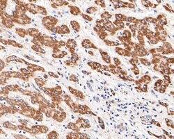Thermo Scientific Kir5.1 (KCNJ16) Polyclonal Antibody:Antibodies, Polyclonal