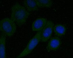 Invitrogen CD68 Polyclonal Antibody 100 &mu;L; Unconjugated:Antibodies,