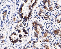 Invitrogen CD68 Polyclonal Antibody 100 &mu;L; Unconjugated:Antibodies,