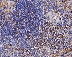 Invitrogen CD68 Polyclonal Antibody 100 &mu;L; Unconjugated:Antibodies,
