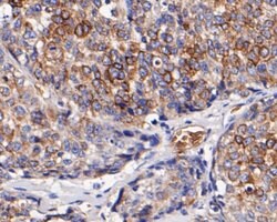 Invitrogen CD68 Polyclonal Antibody 100 &mu;L; Unconjugated:Antibodies,