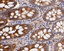 Invitrogen CD68 Polyclonal Antibody 100 &mu;L; Unconjugated:Antibodies,