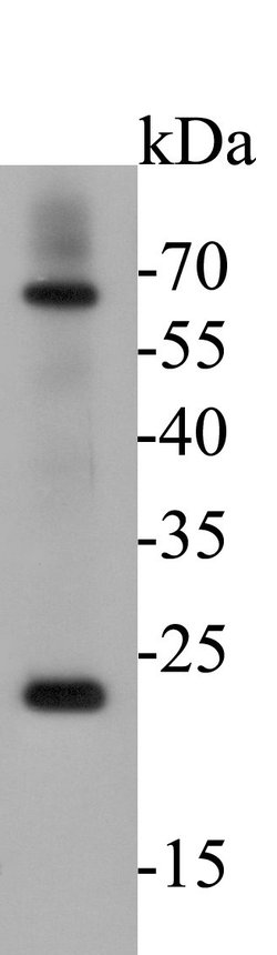 Invitrogen CD68 Polyclonal Antibody 100 &mu;L; Unconjugated:Antibodies,