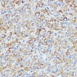 Invitrogen ABI1 Polyclonal Antibody 100 μL; Unconjugated:Antibodies,